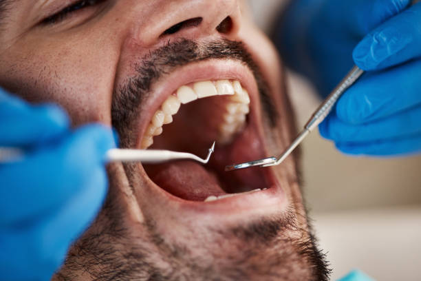 Best Emergency Dentist for Knocked-Out Tooth in Pilot Mountain, NC