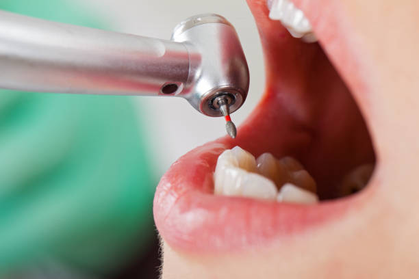Best Emergency Dental Extractions in Pilot Mountain, NC
